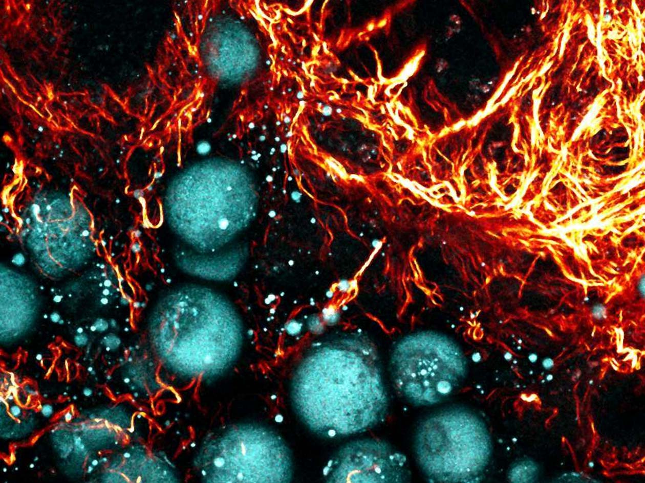 <hr>Tumeur sur glande mammaire observée en microscopie multi-photonique, SHG et THG. © IMAG’IC, T. Guilbert.