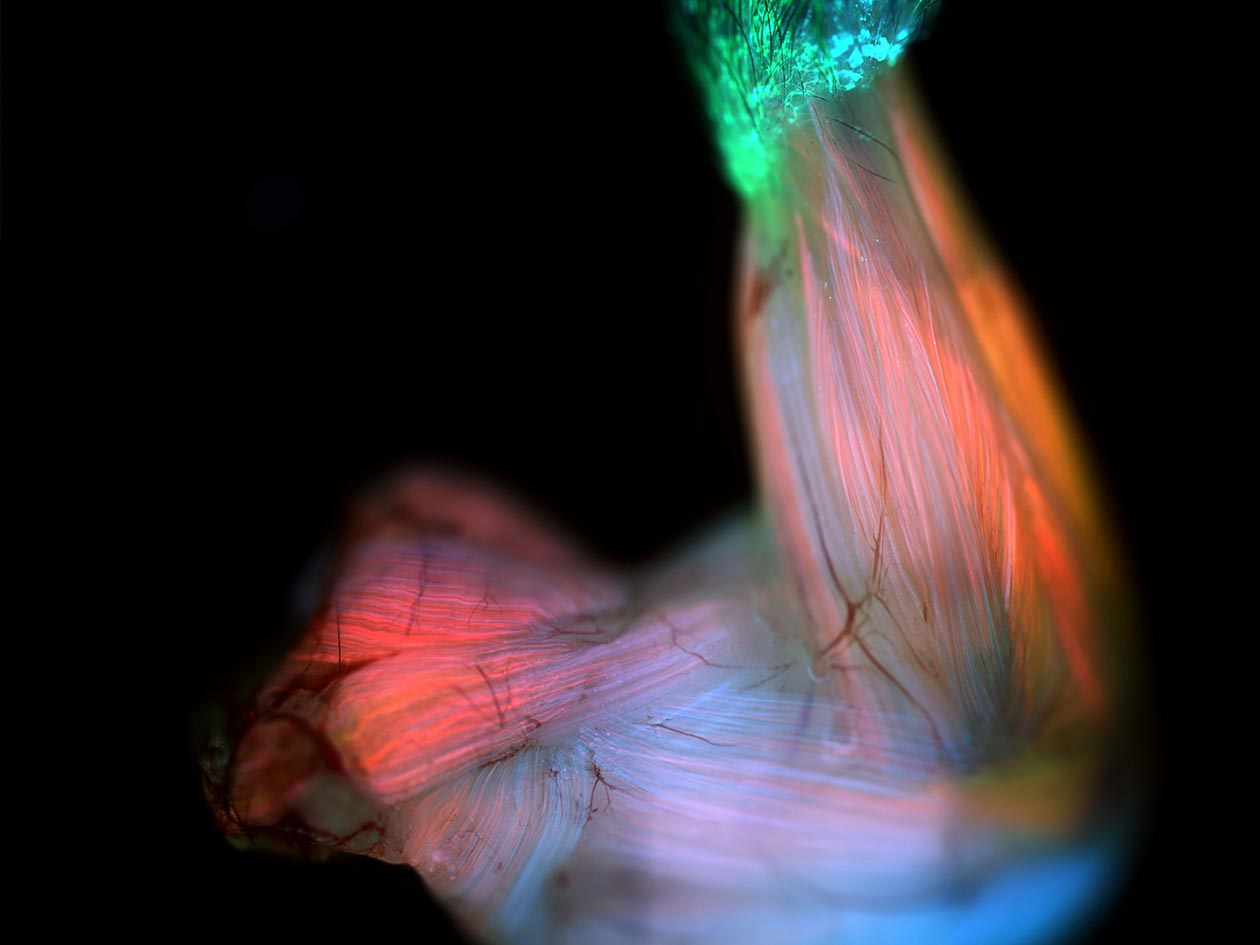 <hr>Fibre musculaire observée en microscopie plein champ. © IMAG’IC, M. Dos-Santos.