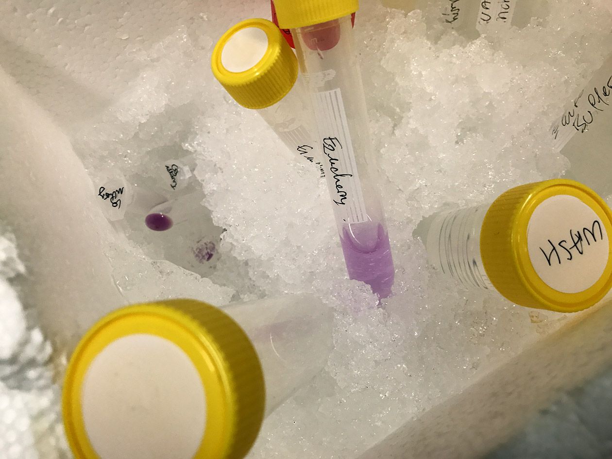 <hr>Protéine Cas9-mCherry après élution de la colonne de nickel lors de la première étape de purification.