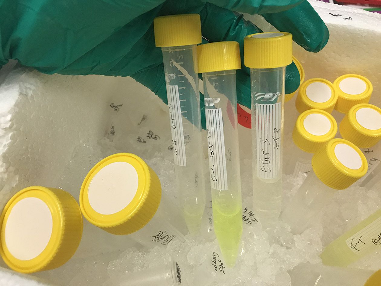 <hr>Protéine Cas9-GFP après élution de la colonne de nickel lors de la première étape de purification.