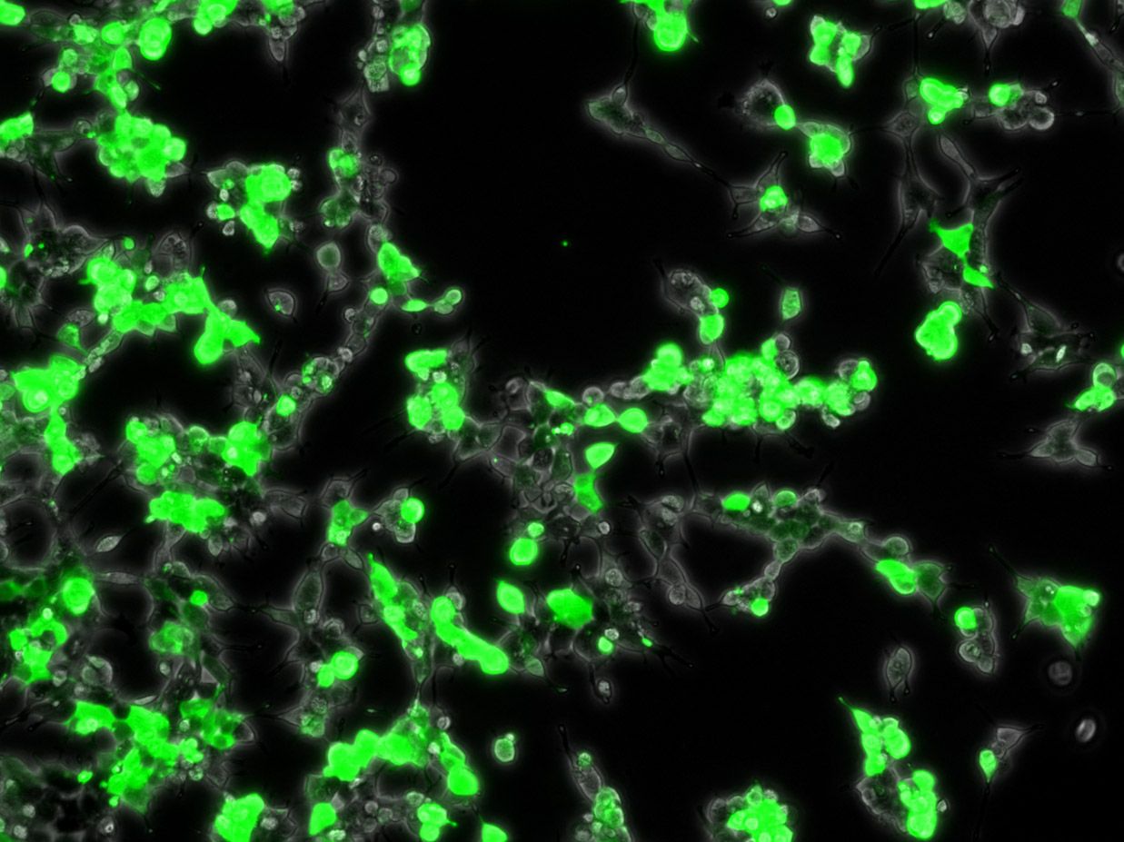 <hr>Cellules HEK293 exprimant la protéine fluorescente GFP après édition du génome.