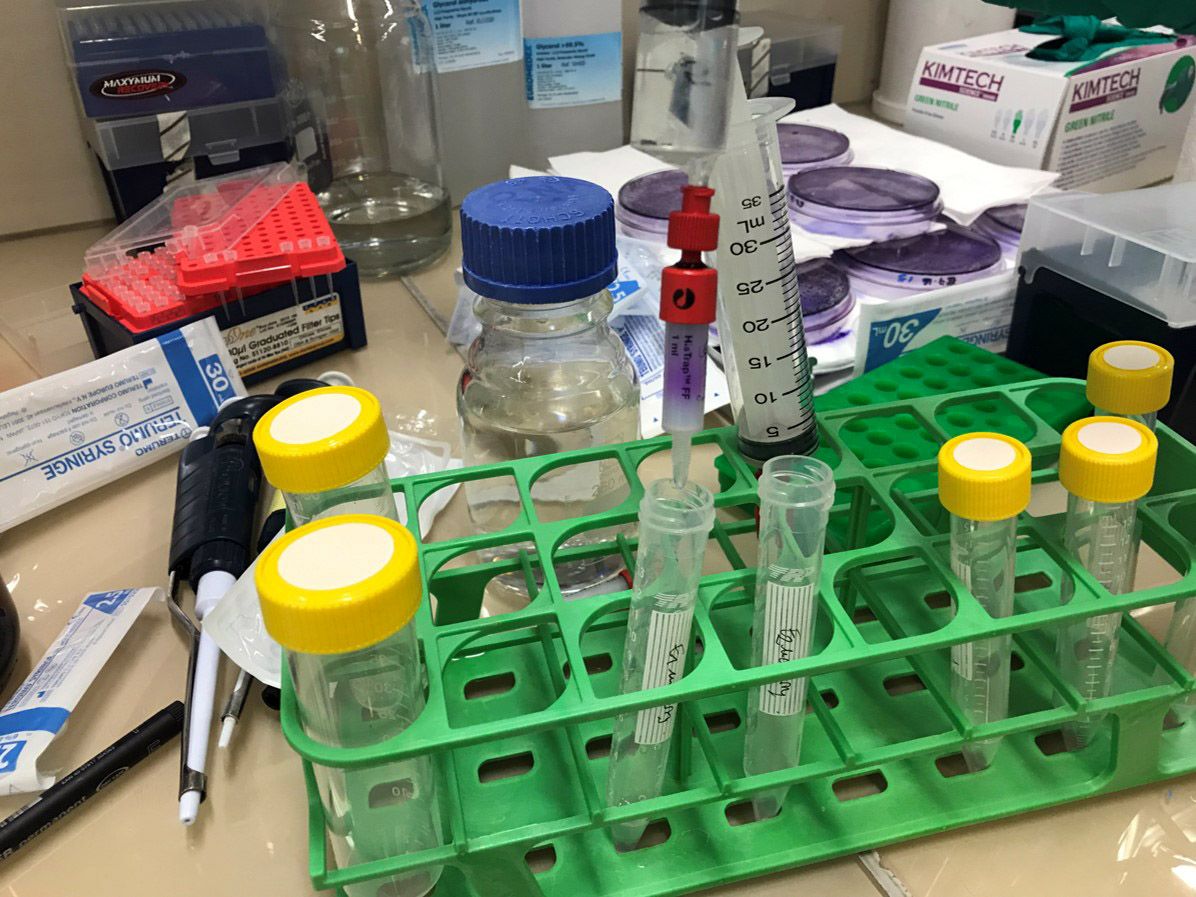 <hr>Elution de la protéine Cas9-mCherry de la colonne de nickel lors de la première étape de purification.